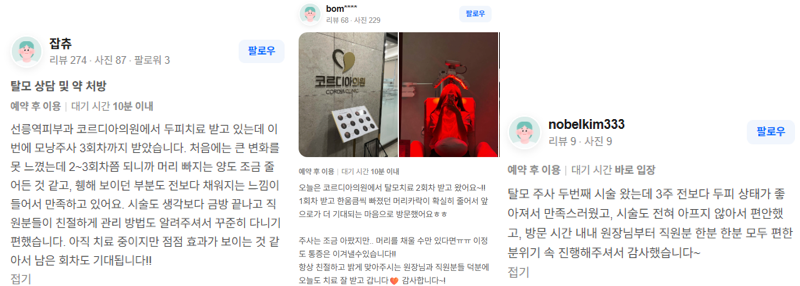 학동역피부과 원형탈모, 자연 회복을 기다려도 될까요? 사진 2