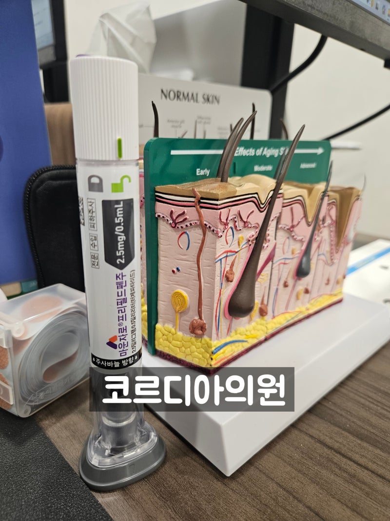 선릉 마운자로, 체중은 줄었는데 머리카락도 빠진다면? 마운자로와 탈모 이야기