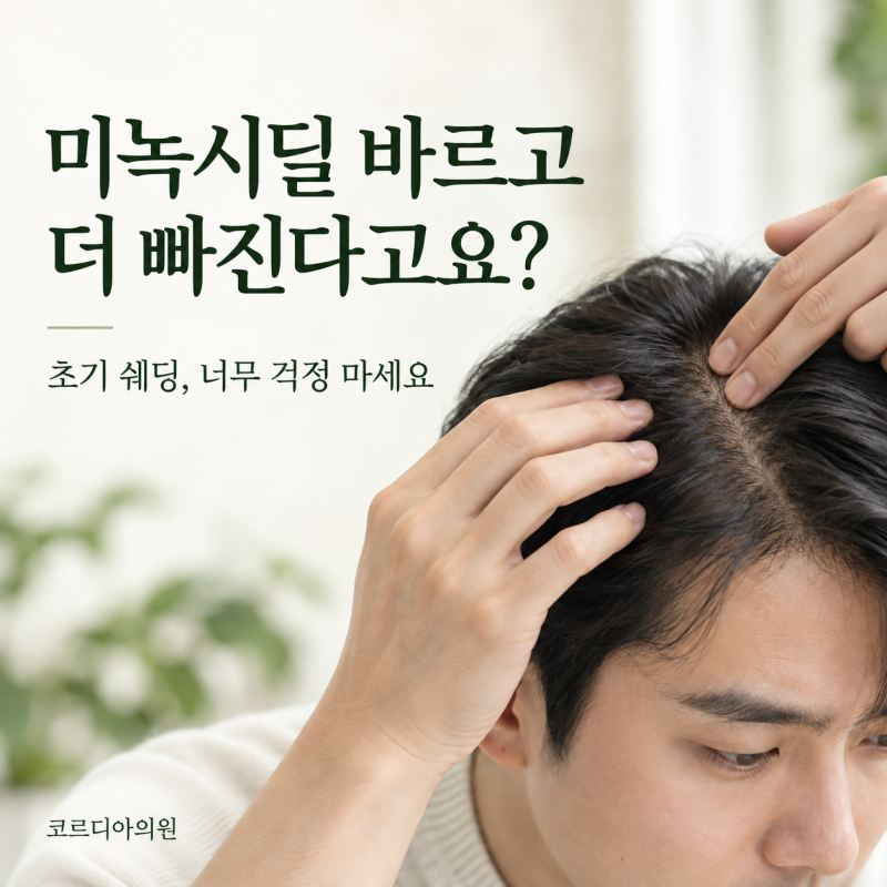 미녹시딜 바르고 머리가 더 빠져요, 쉐딩 현상 괜찮을까요? | 선릉 탈모치료
