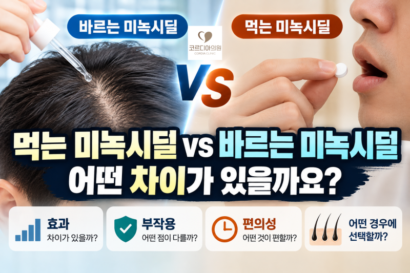 먹는 미녹시딜 vs 바르는 미녹시딜, 어떤 차이가 있을까요?|선릉 탈모치료 병원