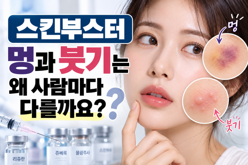 스킨부스터 멍과 붓기는 왜 사람마다 다를까요? 원인부터 회복 기간까지