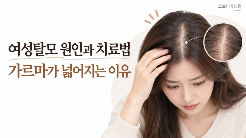 여성탈모 원인과 치료법, 가르마가 넓어지는 이유 | 선릉역 탈모치료의원