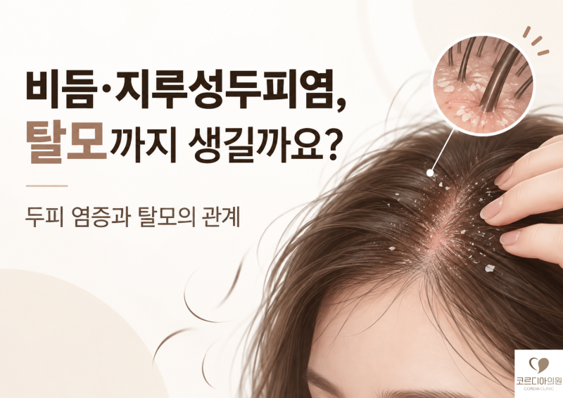비듬과 지루성두피염이 탈모에 미치는 영향｜두피 염증이 머리카락을 빠지게 할까요?