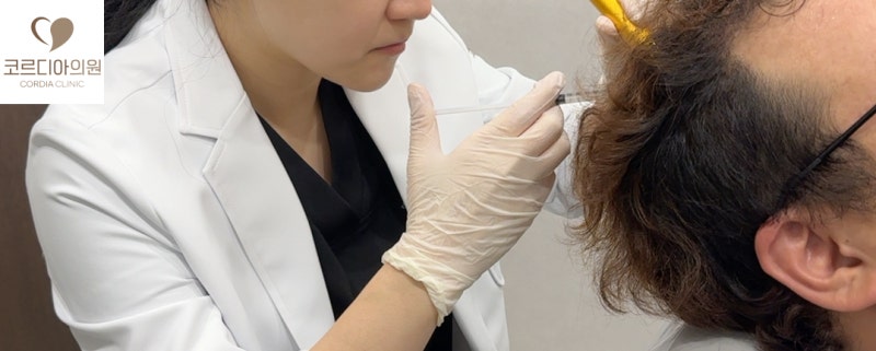 두피 PRP 주사, 탈모치료 효과는 어느 정도일까요? 모발 밀도와 임상연구 결과 | 선릉 탈모치료 코르디아의원 사진 3