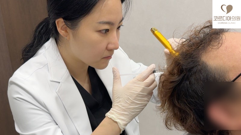 탈모 주사치료는 몇 번 받아야 할까요? 3주 간격 치료와 효과 평가 시점 | 선릉역 탈모치료 코르디아의원