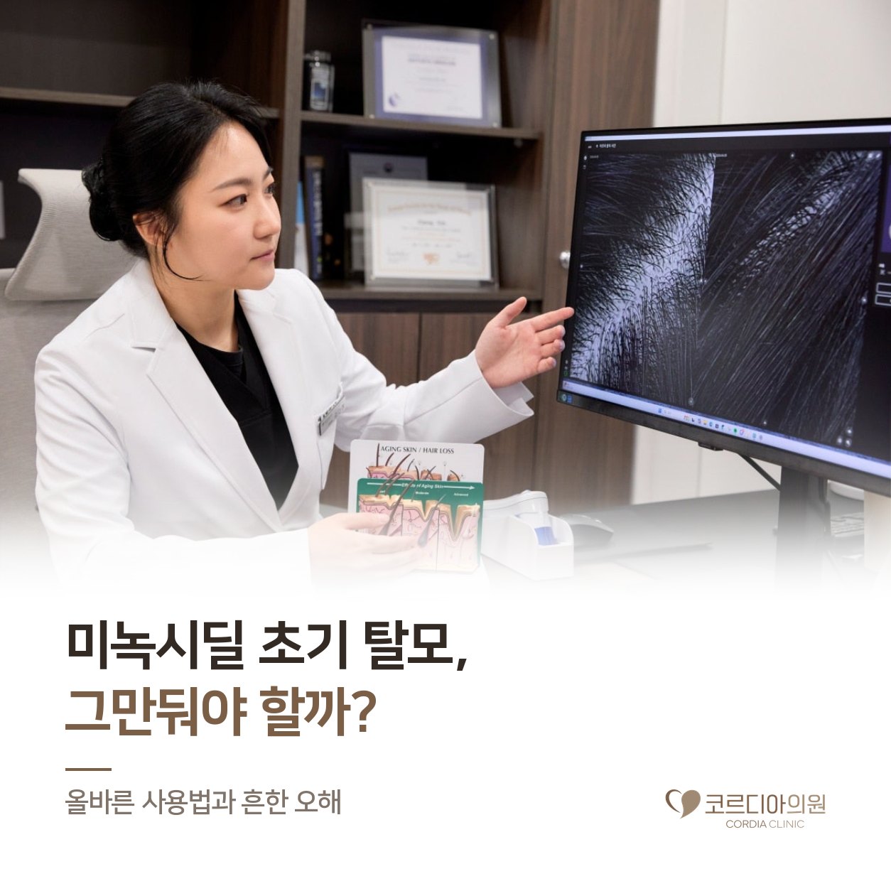 선릉 탈모치료 미녹시딜 초기 탈모, 그만둬야 할까? 올바른 사용법과 흔한 오해