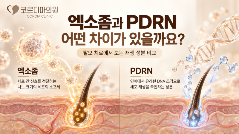 역삼동 탈모 두피 엑소좀과 PDRN, 어떤 차이가 있을까요? 탈모 치료 효과와 실제 임상연구