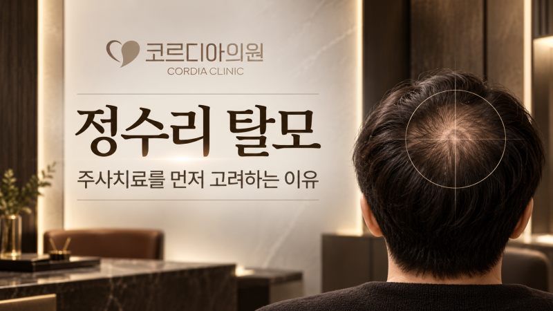 대치동 정수리 탈모, 모발이식보다 주사치료를 먼저 고려하는 이유는?
