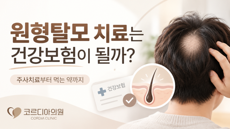 선릉역 원형탈모 치료는 건강보험이 될까요? 주사치료부터 먹는 약까지 알아보기