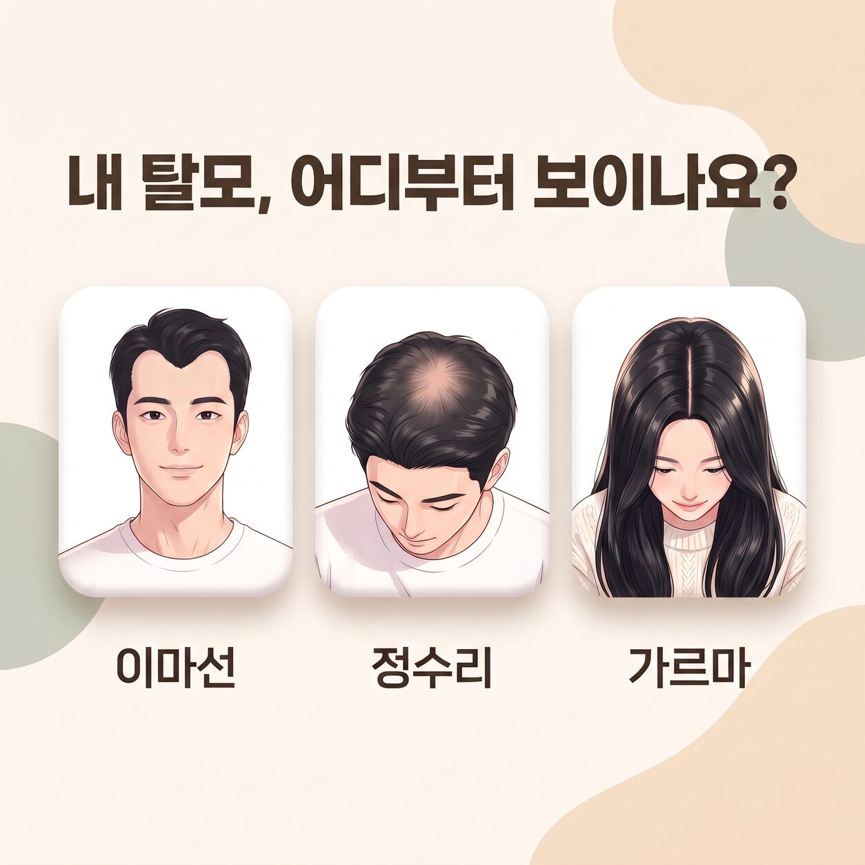 선릉역 탈모 자가진단: 지금 내 탈모는 어느 단계일까? 사진 2