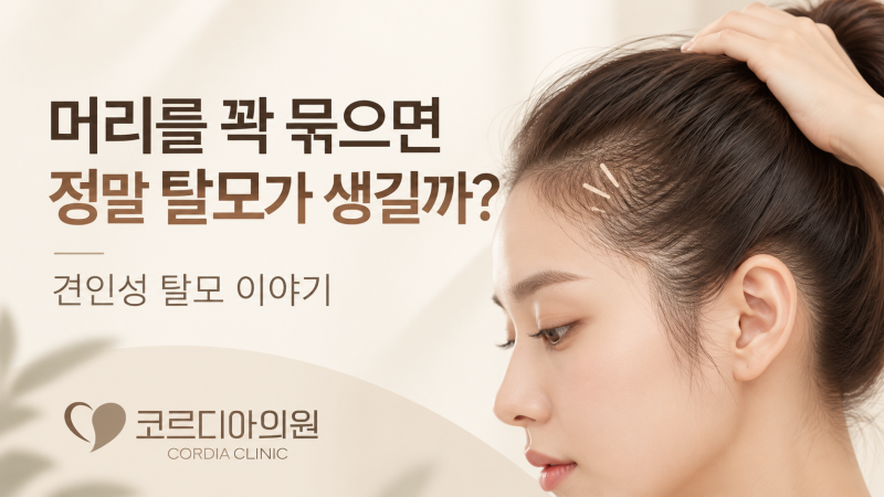 머리를 꽉 묶으면 정말 탈모가 생길까? 견인성 탈모의 원인과 회복 가능성 | 선릉역 탈모병원